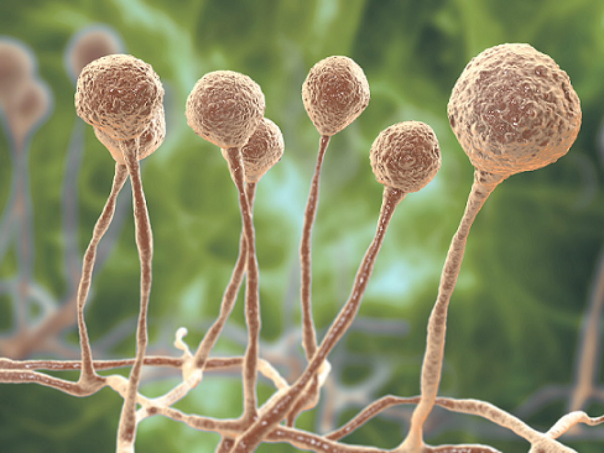 Mucormycosis is caused by a mould from the Zygomycetes family